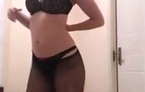 Exposed crazy hairy slut 