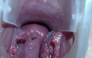 Teen exploring cervix & deep vagina with speculum