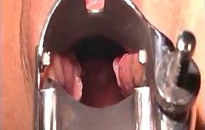 Blondie Gets A Full Examination