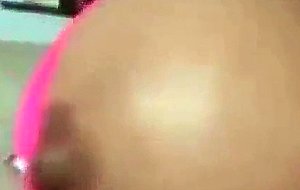 A lady with an enormous 10 kilo boobs